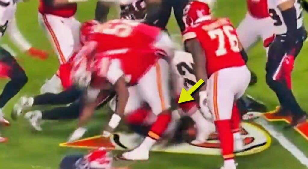 Wanya Morris' hyperextension